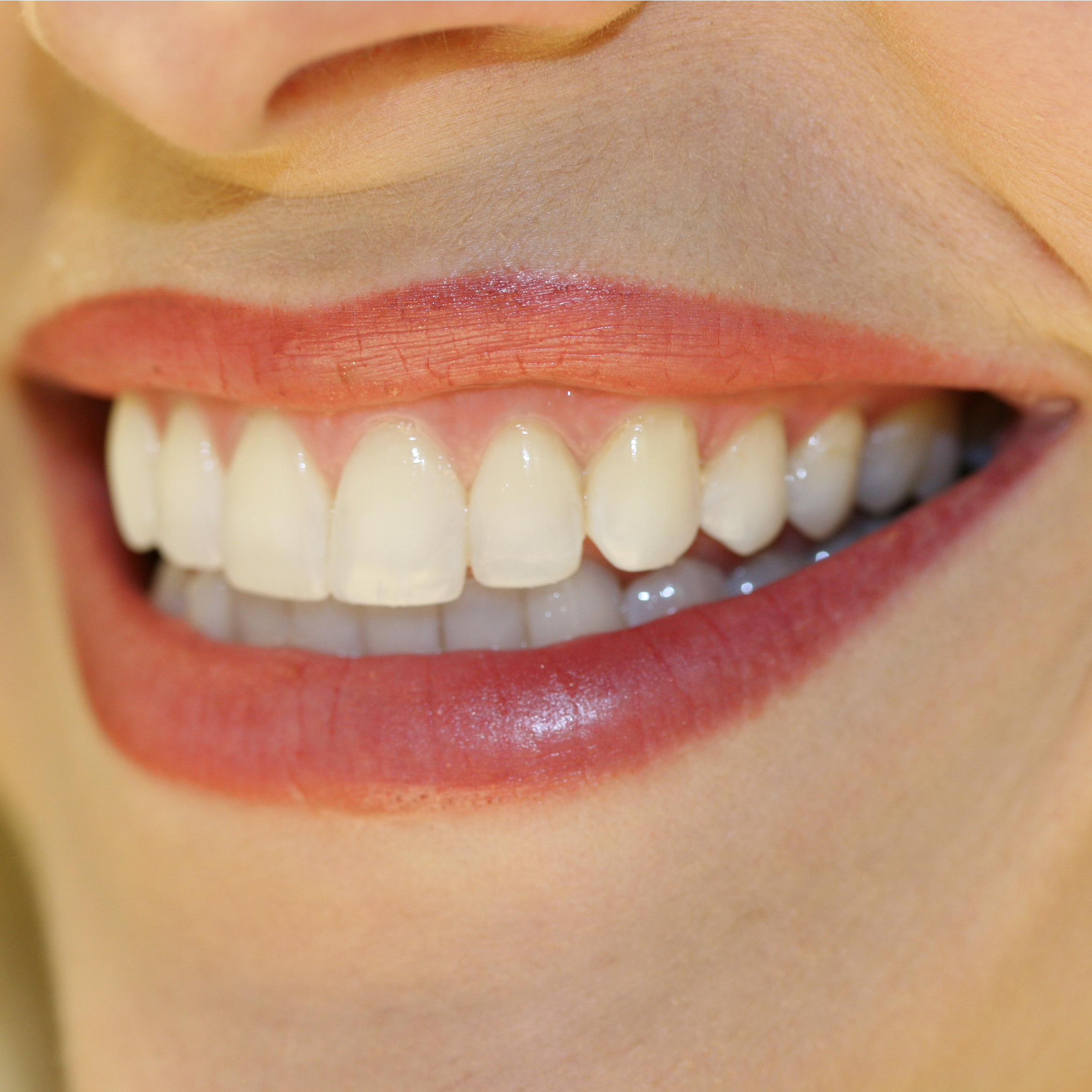 smile dental